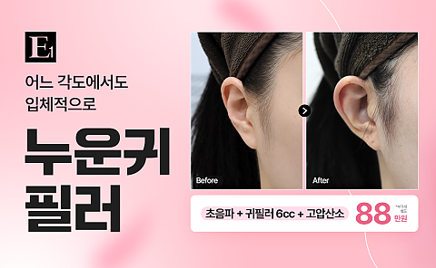 누운귀 필러로 어느 각도에서도 입체감 완성! 